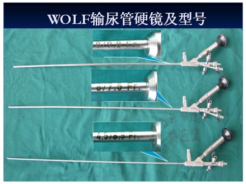 膀胱结石手术要多少钱？(图3)