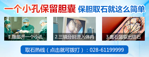 胆结石患者必看：胆结石的4大饮食禁忌(图2)
