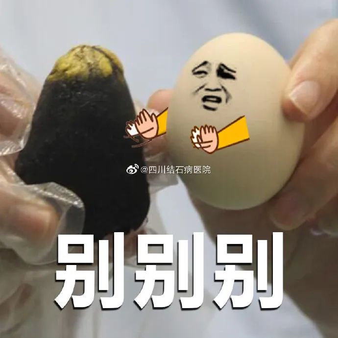 胆结石拖一拖无所谓？四川胆结石专家：那是你没见识到它的“杀伤力”(图5)