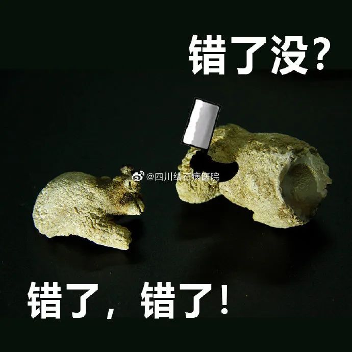 胆结石拖一拖无所谓？四川胆结石专家：那是你没见识到它的“杀伤力”(图6)